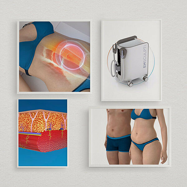 General Animation 600x600